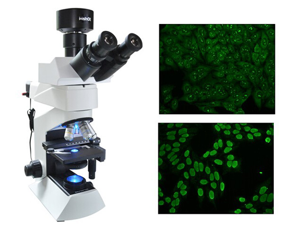 LED荧光显微镜在间接免疫荧光中的应用 - 明美光电