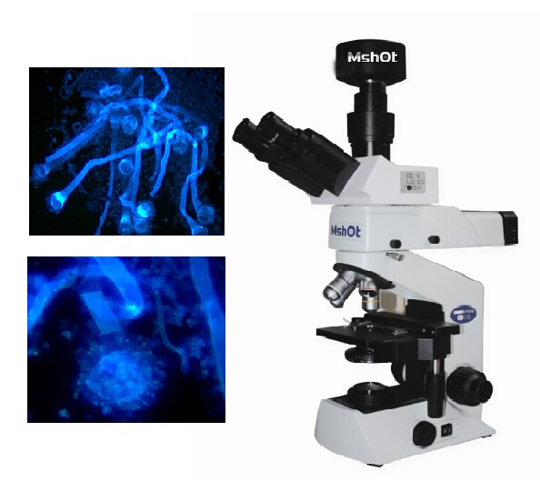 UV LED荧光显微镜在真菌感染检测中的应用
