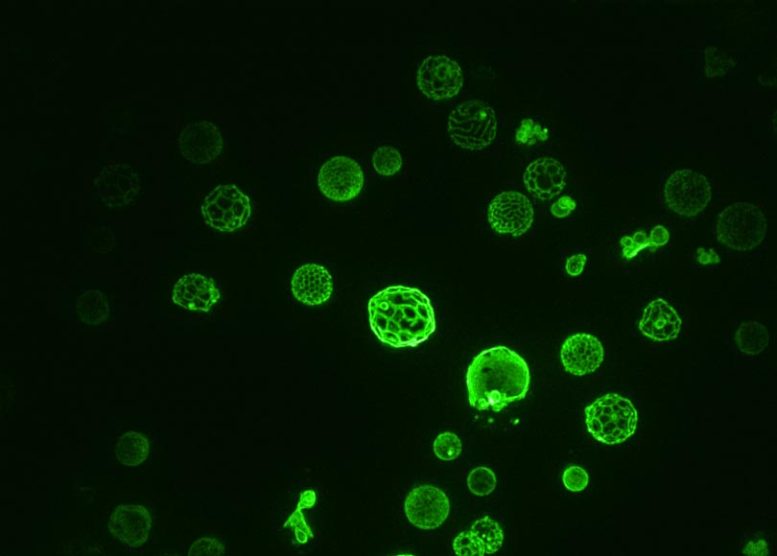 荧光显微镜拍摄的酵母菌