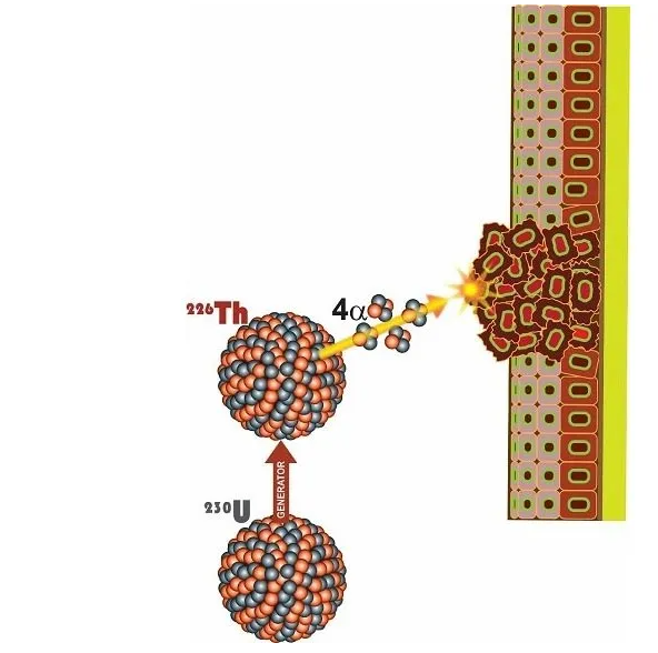 阿尔法粒子轰击癌症组织